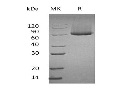 Recombinant Mouse Glypican-1/GPC1 Protein (His Tag) - ABMIUM