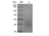 Recombinant Human CD3D&CD3E Heterodimer (C-6His) - ABMIUM