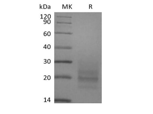 Recombinant Human CD3D&CD3E Heterodimer (C-6His) - ABMIUM