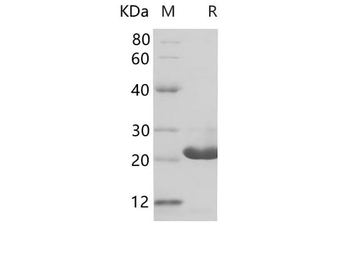 SDS-PAGE analysis of Human PUMA/BBC3 proteins, 2 μg/lane of Recombinant Human PUMA/BBC3 proteins was resolved with SDS-PAGE under reducing conditions, showing bands at 20-24 kDa.