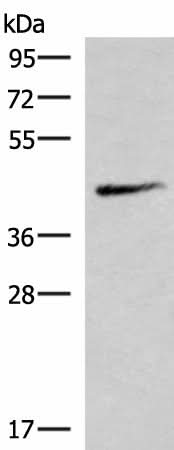 Western blot analysis of Mouse lung tissue lysate using SMPD2 Polyclonal Antibody at dilution of 1:1000