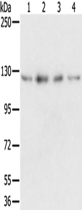Anti-Human/Mouse/Rat RBM5 Antibody - ABMIUM