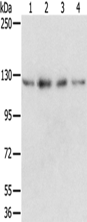 Anti-Human/Mouse/Rat RBM5 Antibody - ABMIUM