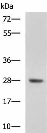 Western blot analysis of Mouse liver tissue lysate using DHRS2 Polyclonal Antibody at dilution of 1:800