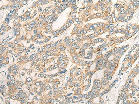 Anti-Human CCL16 Antibody - ABMIUM