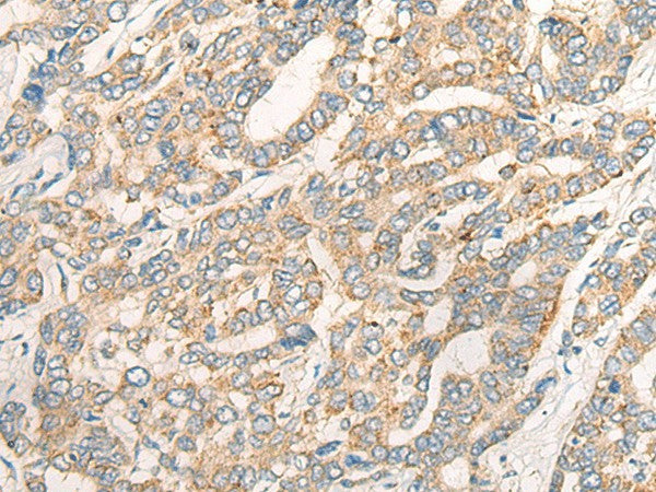 Anti-Human CCL16 Antibody - ABMIUM