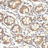 Immunohistochemistry analysis of paraffin-embedded human colon using IL22RA1 Polyclonal Antibody at dilution of 1:200.