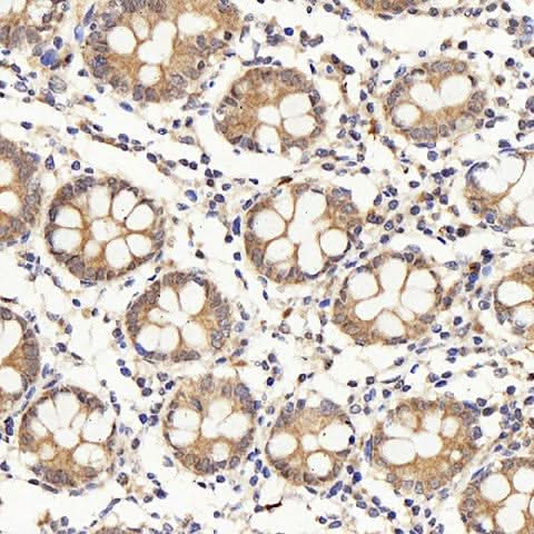 Immunohistochemistry analysis of paraffin-embedded human colon using IL22RA1 Polyclonal Antibody at dilution of 1:200.