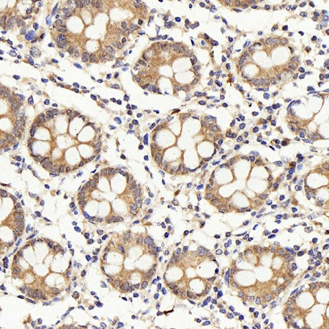 Immunohistochemistry analysis of paraffin-embedded human colon using IL22RA1 Polyclonal Antibody at dilution of 1:200.