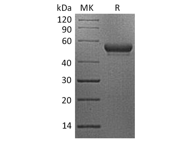 Recombinant Human CD160/BY55 Protein (Fc Tag) - ABMIUM