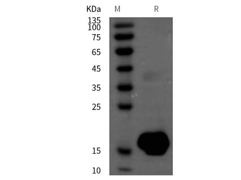 SDS-PAGE analysis of Rat Interleukin-2/IL-2 proteins, 2 μg/lane of Recombinant Rat Interleukin-2/IL-2 proteins was resolved with SDS-PAGE under reducing conditions, showing bands at 16 kDa.