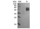 Recombinant Cynomolgus Interleukin-4 Receptor Subunit Alpha/IL-4 Rα Protein (His Tag) - ABMIUM