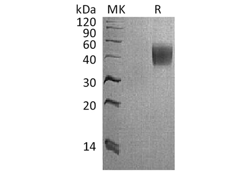 Recombinant Cynomolgus Interleukin-4 Receptor Subunit Alpha/IL-4 Rα Protein (His Tag) - ABMIUM