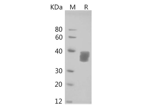 SDS-PAGE analysis of Human Secretogranin 3/SCG3 proteins, 2 μg/lane of Recombinant Human Secretogranin 3/SCG3 proteins was resolved with SDS-PAGE under reducing conditions, showing bands at 52.0 kDa.