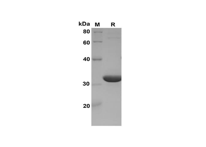 SDS-PAGE analysis of Human ISG15 proteins, 2 μg/lane of Recombinant Human ISG15 proteins was resolved with SDS-PAGE under reducing conditions, showing bands at 33 kDa.