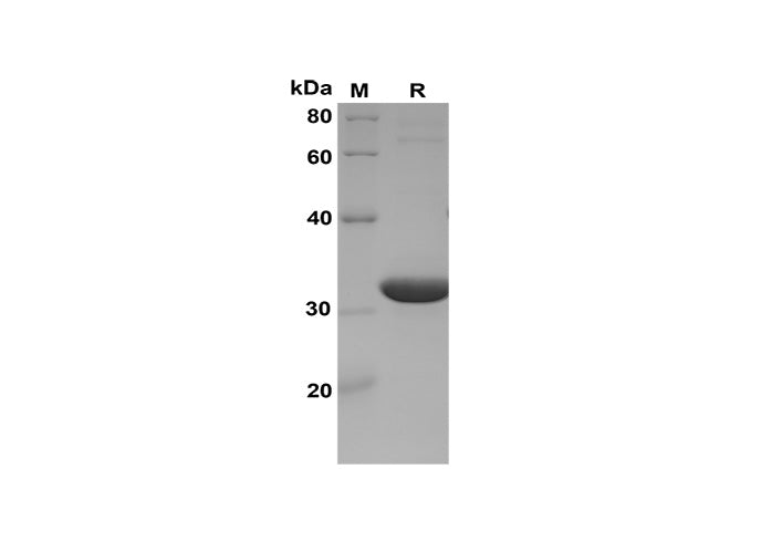 SDS-PAGE analysis of Human ISG15 proteins, 2 μg/lane of Recombinant Human ISG15 proteins was resolved with SDS-PAGE under reducing conditions, showing bands at 33 kDa.