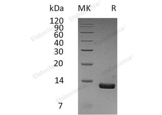 Recombinant Human CCL8/MCP-2 Protein (Human Cells, His Tag) - ABMIUM