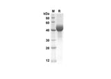 SDS-PAGE analysis of Mouse SP-D proteins, 2 μg/lane of Recombinant Mouse SP-D proteins was resolved with an SDS-PAGE under reducing conditions, showing bands at 38.9 kDa.