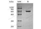 Recombinant Human GLUL Protein (His Tag) - ABMIUM