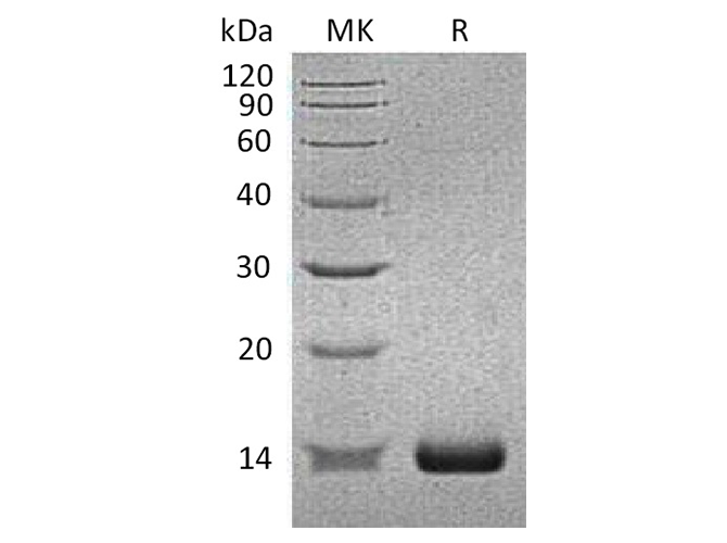 Recombinant Human SAA2/Serum Amyloid A2 Protein (His Tag) - ABMIUM