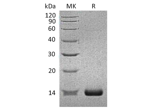 Recombinant Human SAA2/Serum Amyloid A2 Protein (His Tag) - ABMIUM