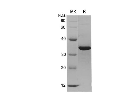 SDS-PAGE analysis of Human SRC/Proto-oncogene c-Src proteins, 2 μg/lane of Recombinant Human SRC/Proto-oncogene c-Src proteins was resolved with SDS-PAGE under reducing conditions, showing bands at 32.4 kDa.