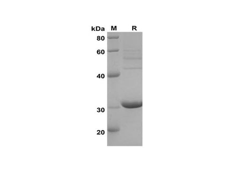SDS-PAGE analysis of Mouse CXCL1/Lymphotactin1/I-TAC proteins, 2 μg/lane of Recombinant Mouse CXCL1/Lymphotactin1/I-TAC proteins was resolved with SDS-PAGE under reducing conditions, showing bands at 31 kDa.