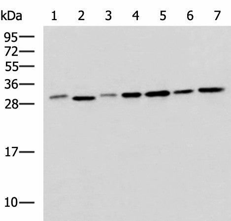 Western blot analysis of 293T LO2 Hela and Jurkat cell lysates using EXOSC4 Polyclonal Antibody at dilution of 1:650