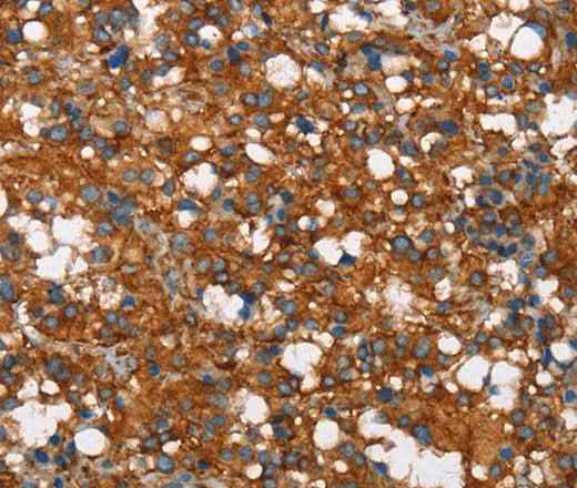 Anti-Human/Mouse/Rat COX5A Antibody