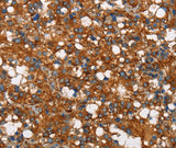 Anti-Human/Mouse/Rat COX5A Antibody - ABMIUM