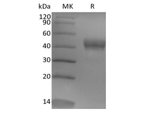 Recombinant Human Tumor-associated Calcium Signal Transducer 2/TROP-2 (248AA, C-6His) - ABMIUM