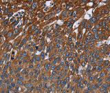 Anti-Human FCGR3A Antibody - ABMIUM