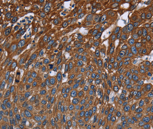 Anti-Human FCGR3A Antibody - ABMIUM