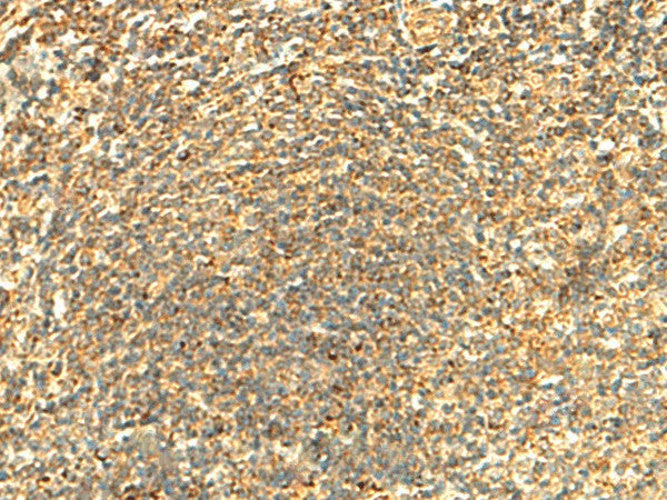 Immunohistochemistry of paraffin-embedded Human tonsil tissue using ABHD10 Polyclonal Antibody at dilution of 1:50(×200)