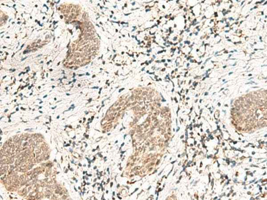 Anti-Human/Mouse SNRPG Antibody