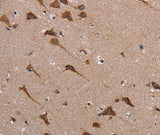 Anti-Human POMT1 Antibody - ABMIUM