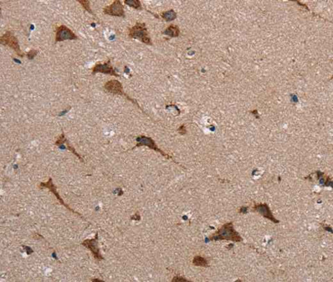 Anti-Human POMT1 Antibody