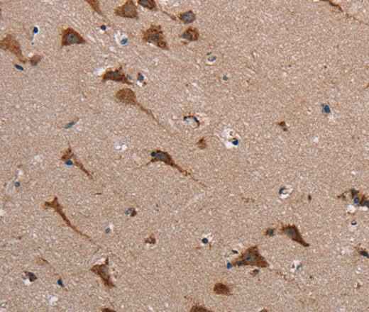 Anti-Human POMT1 Antibody