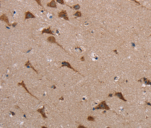 Anti-Human POMT1 Antibody - ABMIUM