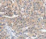 Anti-Human/Mouse/Rat PRKD1 Antibody - ABMIUM