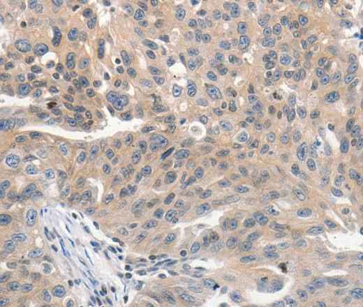 Anti-Human/Mouse/Rat PRKD1 Antibody