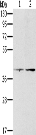 Anti-Human/Mouse/Rat PDGFRL Antibody - ABMIUM