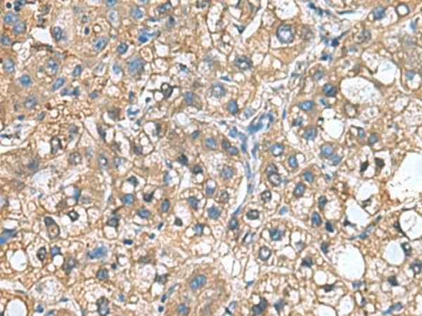 Anti-Human IGLL1 Antibody