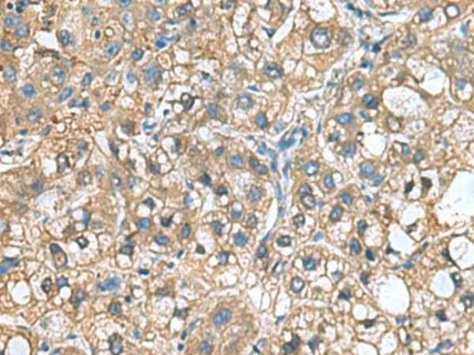 Anti-Human IGLL1 Antibody