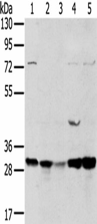 Anti-Human/Mouse TPD54 Antibody - ABMIUM