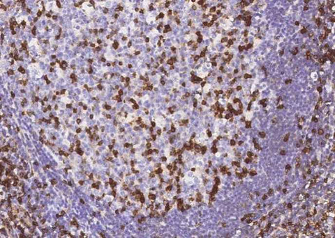 Anti-Human IFITM1 Antibody [A1283] - ABMIUM