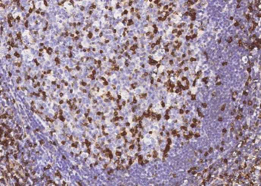 Anti-Human IFITM1 Antibody [A1283] - ABMIUM