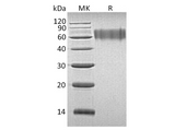 Recombinant Human LYPD3 Protein (His Tag) - ABMIUM
