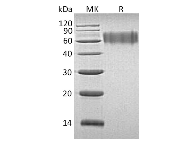 Recombinant Human LYPD3 Protein (His Tag) - ABMIUM
