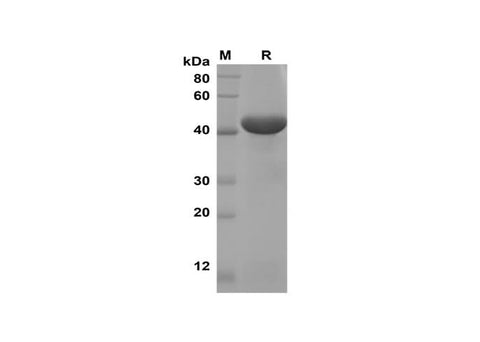 SDS-PAGE analysis of Rat TNF-α proteins, 2 μg/lane of Recombinant Rat TNF-α proteins was resolved with SDS-PAGE under reducing conditions, showing bands at 43 kDa.